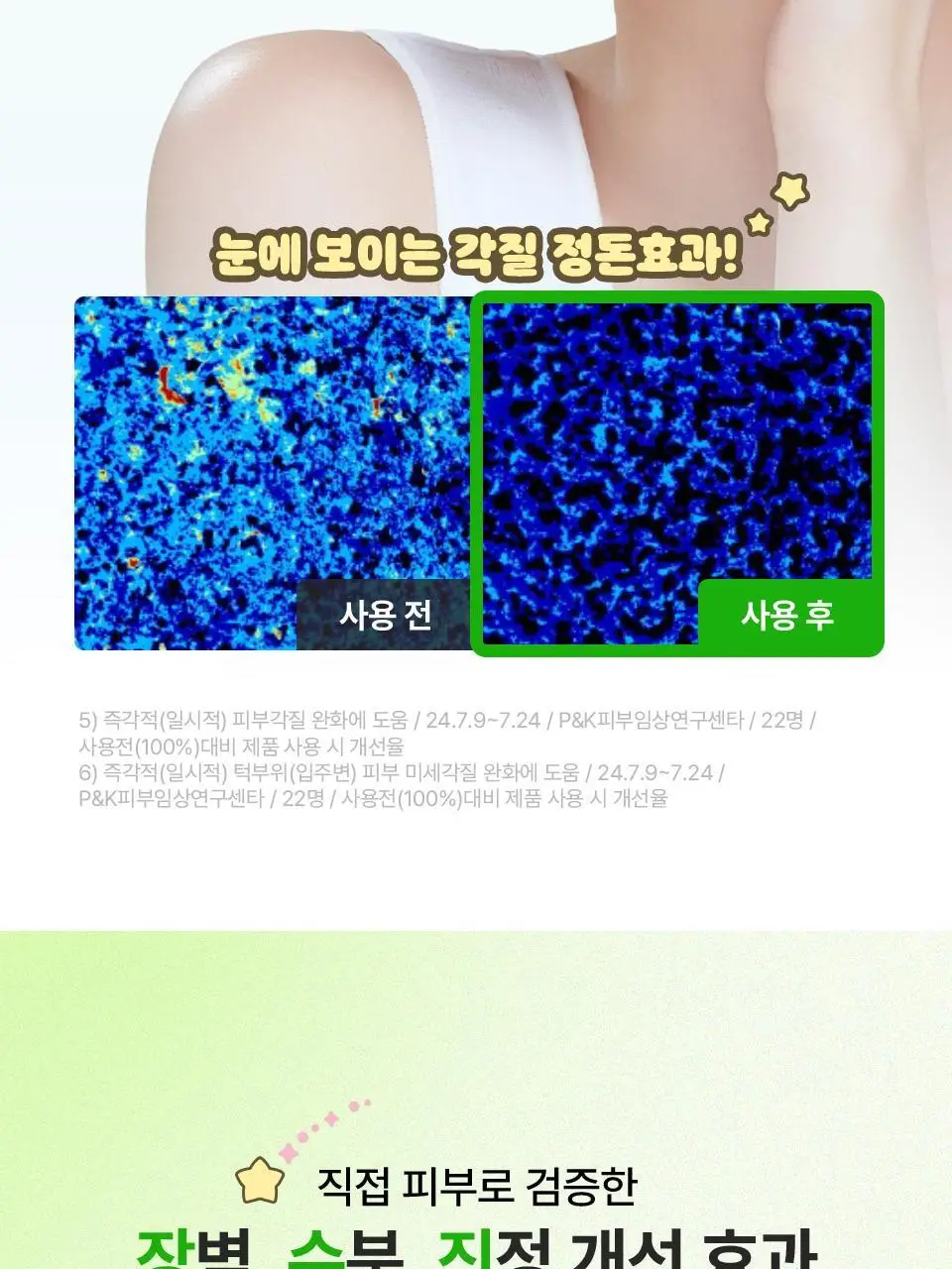 [망곰 콜라보] 아이소이 모이스춰 닥터 장수진 수분크림 100ml 대용량 기획 (+10ml+맥세이프 카드지갑) 상세페이지 10